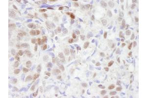 Immunohistochemistry (IHC) image for anti-Transducin (Beta)-Like 1 X-Linked Receptor 1 (TBL1XR1) (AA 100-150) antibody (ABIN7448826) (TBL1XR1 Antikörper  (AA 100-150))