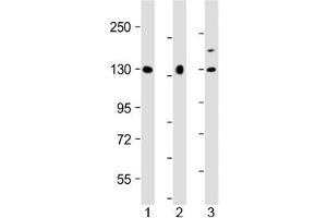 Western blot testing of human 1) U-87 MG, 2) HeLa and 3) BxPC-3 cell lysate with MGEA5 antibody at 1:2000. (MGEA5 Antikörper  (AA 236-269))