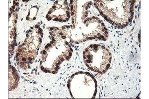 Image no. 3 for anti-NIF3 NGG1 Interacting Factor 3-Like 1 (NIF3L1) antibody (ABIN1496615) (NIF3L1 Antikörper)