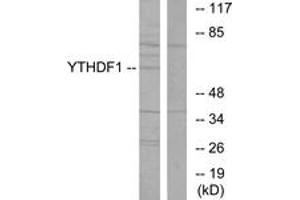 Western blot analysis of extracts from 293 cells, using YTHDF1 Antibody.