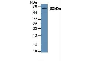 Detection of CD55 in Rat Brain Tissue using Polyclonal Antibody to Cluster Of Differentiation 55 (CD55) (CD55 Antikörper  (AA 35-285))