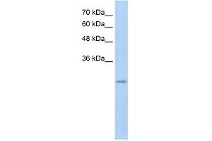 WB Suggested Anti-RFPL3 Antibody Titration:  5. (RFPL3 Antikörper  (Middle Region))