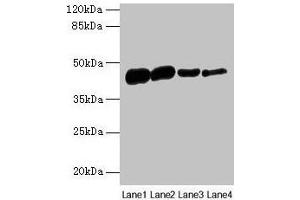 Western blot All lanes: ACTA1 antibody at 16 μg/mL Lane 1: Rat heart tissue Lane 2: Mouse skeletal muscle tissue Lane 3: Human placenta tissue Lane 4: CEM whole cell lysate Secondary Goat polyclonal to rabbit IgG at 1/10000 dilution Predicted band size: 43 kDa Observed band size: 43 kDa (Actin Antikörper  (AA 3-377))