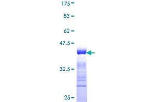 DIS3 Protein (AA 861-956) (GST tag)