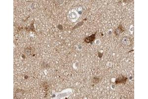 ABIN6276435 at 1/100 staining human brain tissues sections by IHC-P.