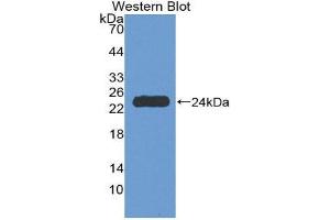 Western Blotting (WB) image for anti-Tumor Necrosis Factor Receptor Superfamily, Member 1A (TNFRSF1A) (AA 248-428) antibody (ABIN1980533)