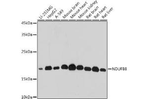 Western blot analysis of extracts of various cell lines, using NDUFB8 antibody (ABIN7268814) at 1:500 dilution. (NDUFB8 Antikörper)