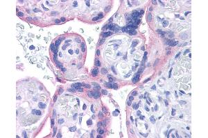 Immunohistochemistry (IHC) image for anti-Insulin Receptor (INSR) (Middle Region) antibody (ABIN2792204) (Insulin Receptor Antikörper  (Middle Region))