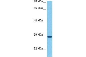 Host:  Rabbit  Target Name:  SNAI1  Sample Tissue:  Human Stomach Tumor  Antibody Dilution:  1ug/ml (SNAIL Antikörper  (N-Term))