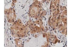 Immunohistochemical staining of paraffin-embedded Human Kidney tissue using anti-DNAJA2 mouse monoclonal antibody. (DNAJA2 Antikörper)