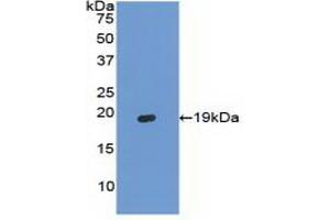 Detection of Recombinant HBa1, Bovine using Polyclonal Antibody to Hemoglobin Alpha 1 (HBa1) (HBA1 Antikörper  (AA 2-142))