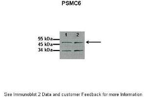 Western Blotting (WB) image for anti-Proteasome (Prosome, Macropain) 26S Subunit, ATPase, 6 (PSMC6) (C-Term) antibody (ABIN2788038)
