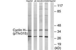 Western blot analysis of extracts from HepG2 cells, Jurkat cells, HuvEc cells and A549 cells, using Cyclin H (Phospho-Thr315) Antibody. (Cyclin H Antikörper  (pThr315))