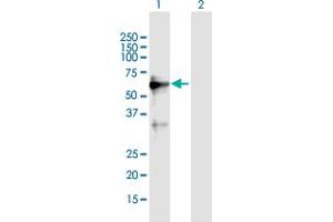 Western Blot analysis of ZNF554 expression in transfected 293T cell line by ZNF554 MaxPab polyclonal antibody. (ZNF554 Antikörper  (AA 1-538))