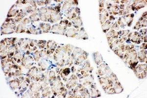 Anti-IGF1 Receptor antibody, IHC(P) IHC(P): Rat Pancreas Tissue (IGF1R Antikörper  (C-Term))