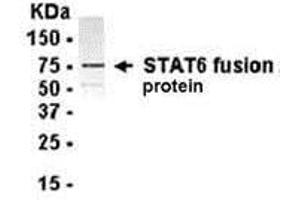 Western Blotting (WB) image for anti-Signal Transducer and Activator of Transcription 6, Interleukin-4 Induced (STAT6) (AA 61-275) antibody (ABIN2468153)