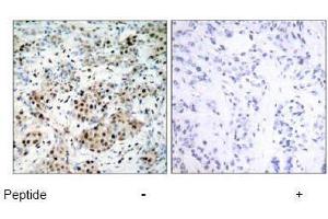 Image no. 1 for anti-cAMP Responsive Element Binding Protein 1 (CREB1) (Ser133) antibody (ABIN197188) (CREB1 Antikörper  (Ser133))