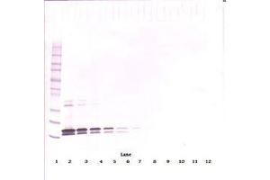 Image no. 2 for anti-Tumor Necrosis Factor (Ligand) Superfamily, Member 13b (TNFSF13B) antibody (ABIN1496804)