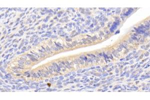 Detection of CA125 in Mouse Uterus Tissue using Polyclonal Antibody to Carbohydrate Antigen 125 (CA125) (MUC16 Antikörper  (AA 2-258))