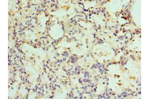 Immunohistochemistry of paraffin-embedded human lung tissue using ABIN7143352 at dilution of 1:100 (Adenylosuccinate Lyase Antikörper  (AA 1-310))