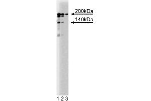 Western blot analysis of Intersectin on rat cerebrum lysate. (Dynamin Associated Protein 160 (DAP160) (AA 800-909) Antikörper)
