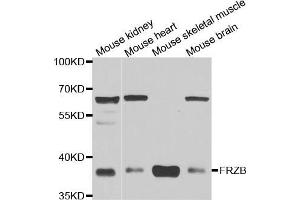 Western blot analysis of extracts of various cell lines, using FRZB antibody (ABIN5973961) at 1/1000 dilution. (FRZB Antikörper)