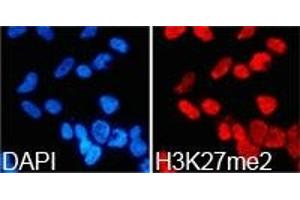 Immunofluorescence analysis of 293T cell using H3K27me2 antibody. (Histone 3 Antikörper  (H3K27me2))