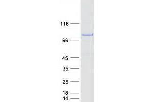 Validation with Western Blot