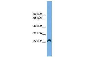 WB Suggested Anti-HAX1 Antibody Titration: 0. (HAX1 Antikörper  (Middle Region))