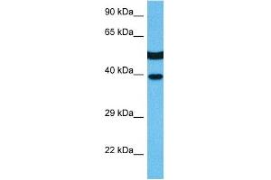 Host:  Mouse  Target Name:  MAPK14  Sample Tissue:  Mouse Kidney  Antibody Dilution:  1ug/ml (MAPK14 Antikörper  (C-Term))