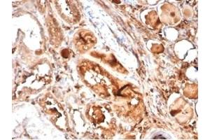 Formalin-fixed, paraffin-embedded human kidney stained with MICA Mouse Recombinant Monoclonal Antibody (MICA/4442). (MICA Antikörper  (AA 1-200))