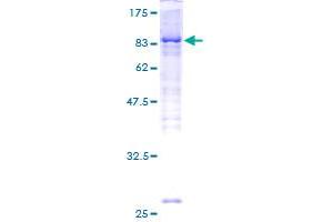 Image no. 1 for Interleukin-1 Receptor-Associated Kinase 3 (IRAK3) (AA 1-596) protein (GST tag) (ABIN1308063) (IRAK3 Protein (AA 1-596) (GST tag))