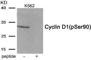 Western blot analysis of extracts from K562 tissue using Cyclin D1 (Phospho-Ser90) antibody. (Cyclin D1 Antikörper  (pSer90))