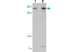 Western blot analysis of TLX2 in rat brain tissue with TLX2 polyclonal antibody  at (lane 1) 0. (TLX2 Antikörper  (N-Term))