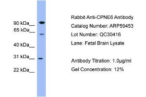 WB Suggested Anti-CPNE6  Antibody Titration: 0. (CPNE6 Antikörper  (Middle Region))