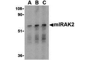 Western Blotting (WB) image for anti-Interleukin-1 Receptor-Associated Kinase 2 (IRAK2) (C-Term) antibody (ABIN1030447)