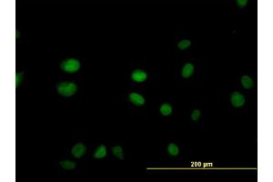 Immunofluorescence of monoclonal antibody to SGK2 on HeLa cell. (SGK2 Antikörper  (AA 293-367))