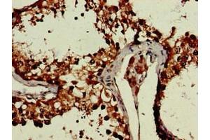 Immunohistochemistry of paraffin-embedded human testis tissue using ABIN7150470 at dilution of 1:100 (CRCP Antikörper  (AA 1-115))