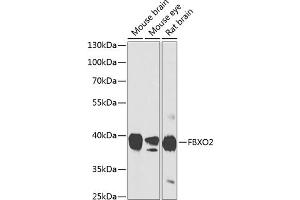 Western blot analysis of extracts of various cell lines, using FBXO2 antibody (ABIN6130381, ABIN6140514, ABIN6140515 and ABIN6224682) at 1:1000 dilution. (FBXO2 Antikörper  (AA 1-296))