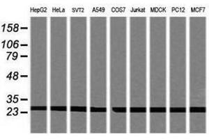 Image no. 2 for anti-Proteasome Subunit alpha 2 (PSMA2) (AA 50-234) antibody (ABIN1491568) (PSMA2 Antikörper  (AA 50-234))