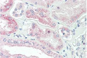 Immunohistochemistry (IHC) image for anti-Solute Carrier Family 4, Sodium Borate Transporter, Member 11 (SLC4A11) (Internal Region) antibody (ABIN571063)