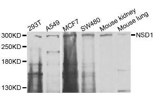 Western blot analysis of extracts of various cell lines, using NSD1 antibody (ABIN6003690) at 1/1000 dilution.