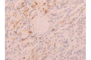 Immunohistochemistry (IHC) image for anti-Toll-Like Receptor 5 (TLR5) (AA 693-858) antibody (ABIN7438379)