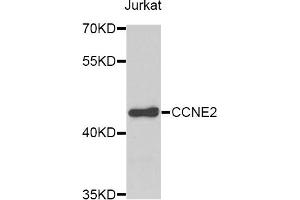 Western blot analysis of extracts of Jurkat cells, using CCNE2 antibody.