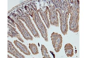 IHC analysis of DDR1 using anti-DDR1 antibody (ABIN7601407). (DDR1 Antikörper  (AA 341-909))