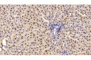 Detection of PRDX2 in Rat Liver Tissue using Polyclonal Antibody to Peroxiredoxin 2 (PRDX2) (Peroxiredoxin 2 Antikörper  (AA 6-164))