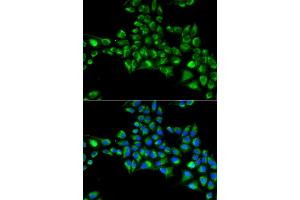 Immunofluorescence analysis of HeLa cells using CYGB antibody . (CYGB Antikörper  (AA 1-190))