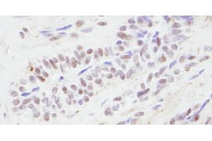 Immunohistochemistry (IHC) image for anti-CREB Binding Protein (CREBBP) (AA 2375-2425) antibody (ABIN7454618) (CBP Antikörper  (AA 2375-2425))