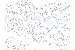 anti-AT Rich Interactive Domain 1A (SWI-Like) (ARID1A) (AA 750-800) antibody