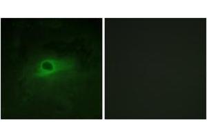 Immunofluorescence analysis of HeLa cells, using CSFR (Ab-809) Antibody. (CSF1R Antikörper  (AA 781-830))